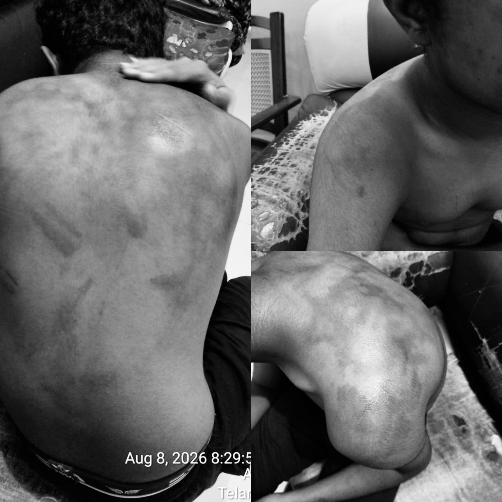 శ్రీచైతన్య స్కూల్లో విద్యార్థిపై దారుణ దాడి